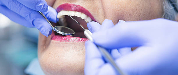 Best Knocked-Out Tooth (Avulsed Tooth) Treatment in Marianne, PA